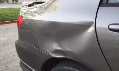 Dent removal